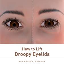 how to lift droopy eyelids beautiful