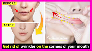 fold lines on the corners of your mouth