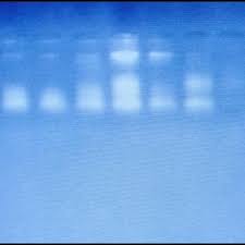 28 gel electropsis of genomic dna