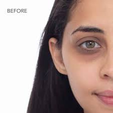 3 steps to conceal dark under eye circles