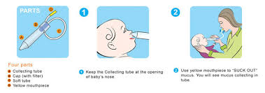 home remedy for stuffy nose in baby