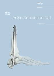 t2 ankle arthrodesis nail stryker