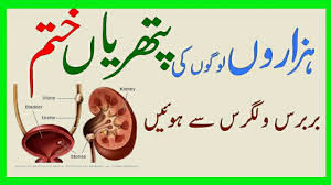 Health Tips Urdu By Dr Arshad Kidney Stones Gurdoon Ki