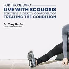 4 scoliosis exercises that really work