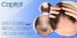 minerals deficiency can cause hair loss