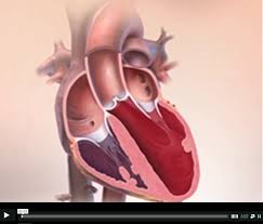 Eine herzmuskelentzündung wird in seltenen fällen nach einer grippeinfektion beobachtet. Herzmuskelentzundung Myokarditis Kardiologie Osypka Herzzentrum Munchen