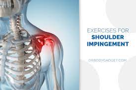 how to fix shoulder impingement the
