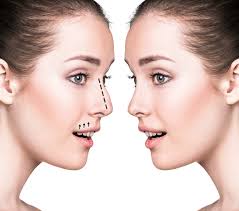 what is the best age to get a nose job