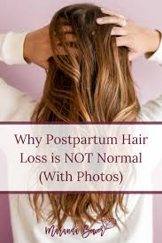 why postpartum hair loss is not normal