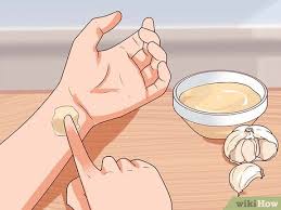 remove warts naturally using garlic