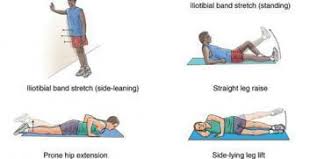 trochanteric bursitis exercises cal