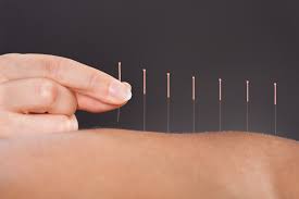 comprendre l acupuncture en dix questions