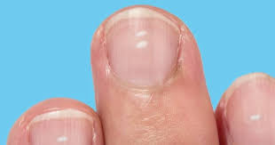 white marks on your nails
