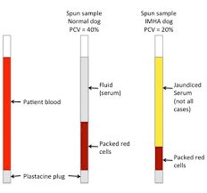 An Illustration To Show How Pcv Is Measured In Capillary