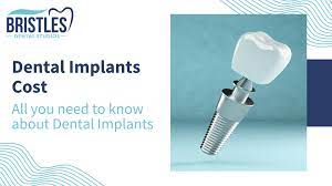 dental implants cost in chandigarh