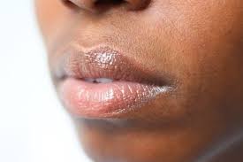 how to heal your dry chapped lips