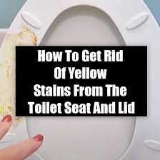 Yellow Stains From The Toilet Seat