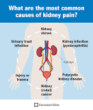 how-can-i-tell-if-my-back-pain-is-kidney-related