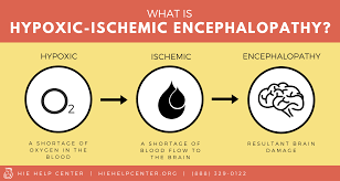 What Is Hypoxic Ischemic Encephalopathy Hie