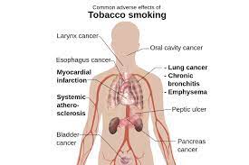 smoking and your musculoskeletal health
