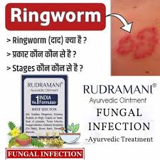 ringworm ointment rudramani 25gm