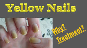 yellowing of the nails causes