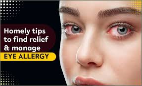 seasonal eye allergy homely tips to