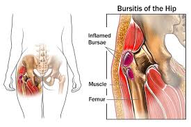 These muscles are separate in the abdomen, but they join. Reasons Your Hips May Hurt