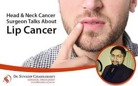 neck cancer surgeon talks about lip cancer