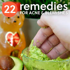 home remes for acne pesky pimples