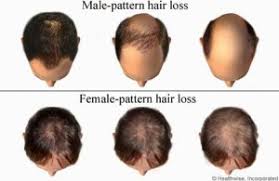 hair loss in men and women diagnosis