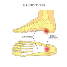 best shoes for plantar fasciitis relief