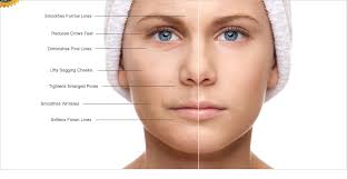 how do injectable cosmetic fillers work