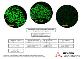 Monoclonal Membranous Glomerulopathy Arkana Laboratories