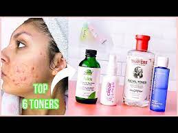 best toners for oily acne e skin