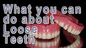 How much of a concern are loose or lost stitches? What Can Be Done About Loose Teeth Youtube
