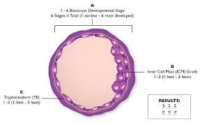 Embryo Grading Blastocyst Implantation Blastocyst Grading