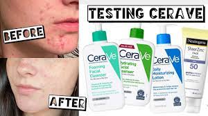 testing cerave for a month for acne