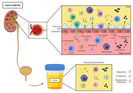 immune urine biomarkers