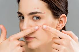 how to get rid of acne spots on face
