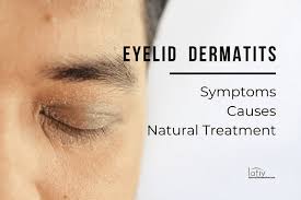 eyelid dermais eczema symptoms