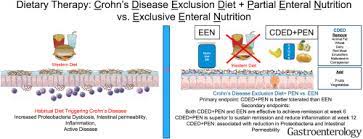 crohn s disease exclusion t plus