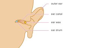 Earwax Color Chart Infection Tarry Earwax And More