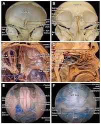 anterior cranial fossa