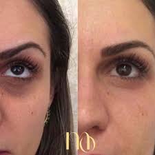 permanent concealer tattoo the