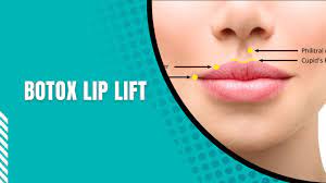 botox lip lift dr tarek aesthetics
