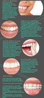 Retainers this method is often used after braces to keep the teeth in. How To Fix Gap In Front Teeth Without Braces