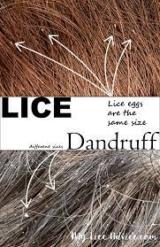 lice vs dandruff 7 key differences