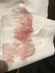 af late by 9 days light pink bleeding