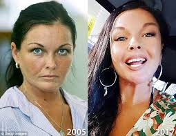 Not the smears and propaganda of the australian mainstream, but the real news. Schapelle Corby S Post Prison Makeover Dr Haworth Believes It S Possible With Fillers Dr Haworth